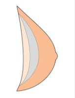 AMOENA NATURA LIGHT BREAST FORM